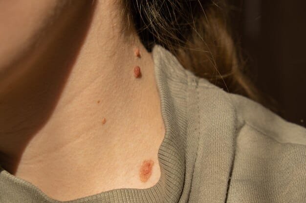 Skin Tag Treatment: Effective Ways to Remove Skin Tags on Face