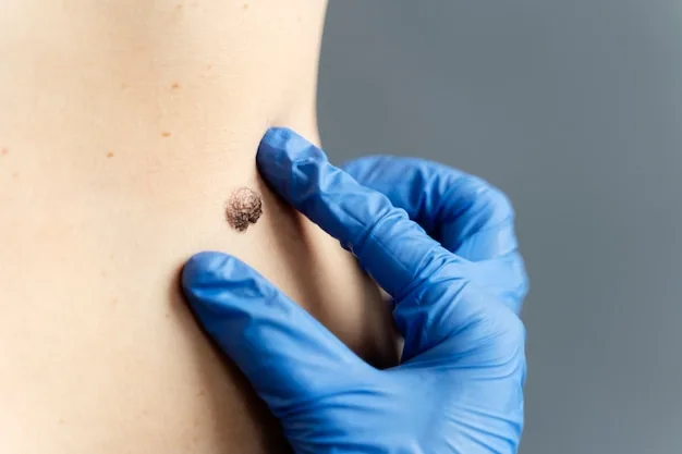 Infected Mole Treatment: How to Safely Treat Infected Moles