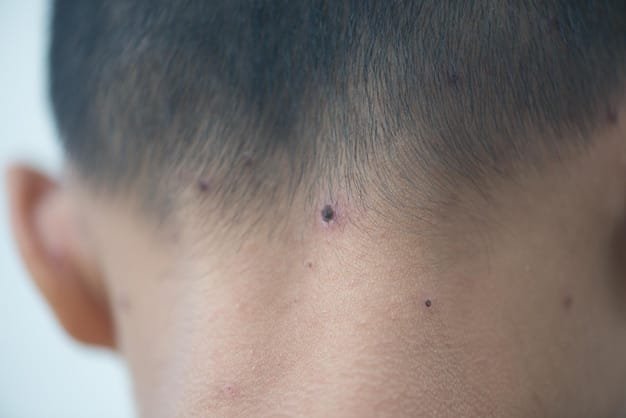 Skin Tag Treatment: Effective Ways to Remove Skin Tags on Face
