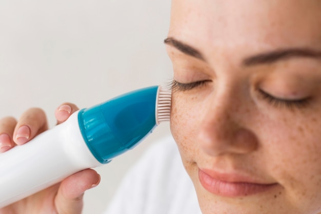 Microdermabrasion Treatment for Acne Scars: Does It Work?