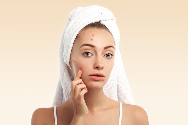 Microdermabrasion Treatment for Acne Scars: Does It Work?