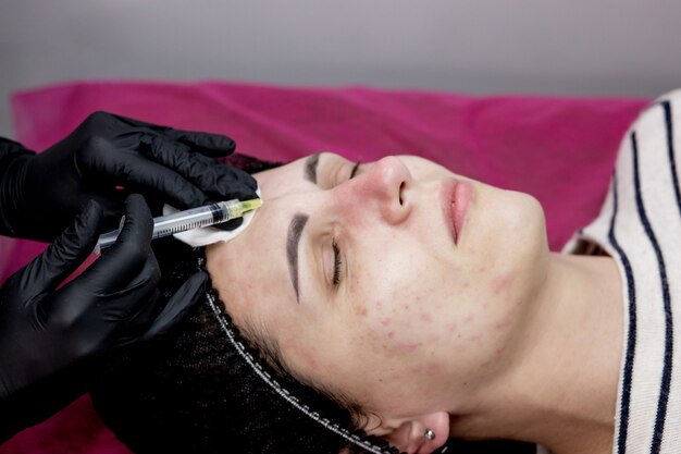 Microdermabrasion Treatment Side Effects: What to Expect