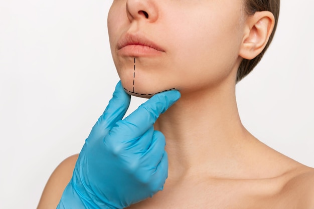 Chin Fat Dissolving Injections: Benefits & Expected Results