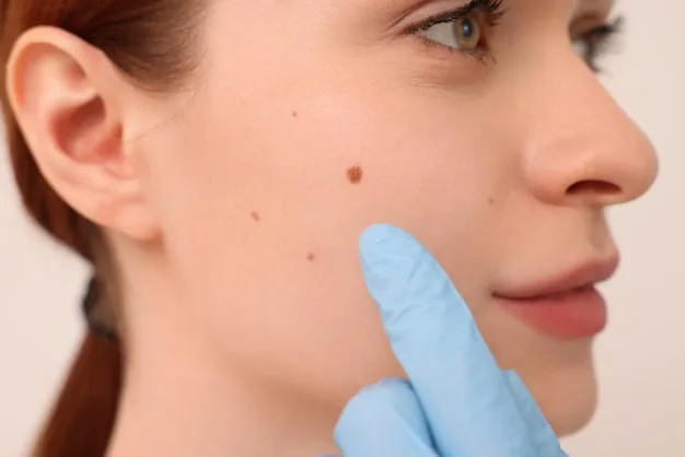 Black Moles on the Face: Safe and Effective Removal Options - Dr Taskeen  Iqbal