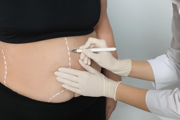 Belly Fat Dissolving Injections: How They Work & Benefits