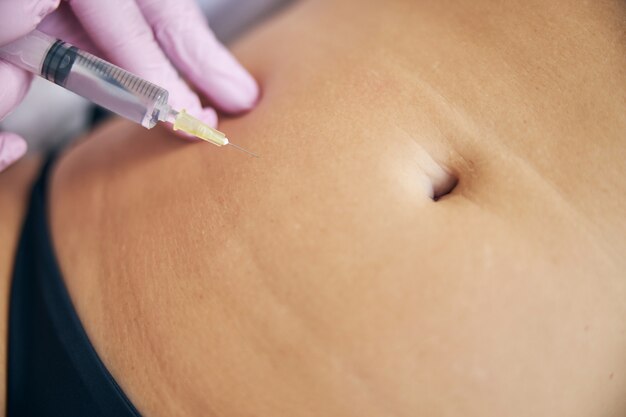 Belly Fat Dissolving Injections: How They Work & Benefits