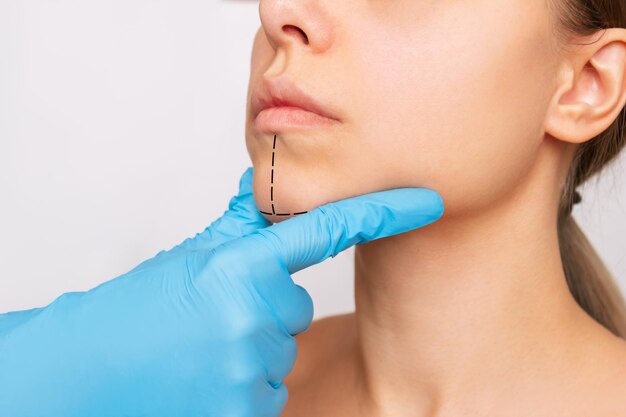 Chin Fat Dissolving Injections: Benefits & Expected Results