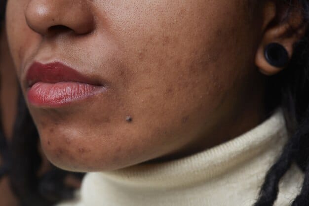 Black Moles on the Face: Safe and Effective Removal Options