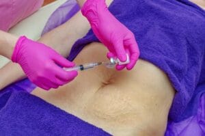 Belly Fat Dissolving Injections: How They Work & Benefits