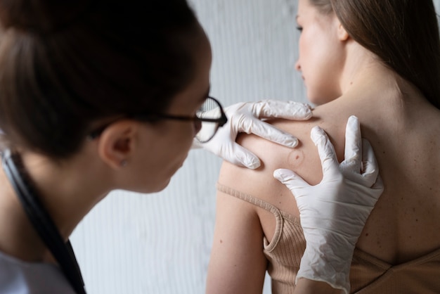 Mole Removal Treatment: Safe Solutions for All Types of Moles
