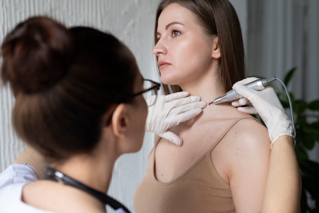 Mole Removal Treatment: Safe Solutions for All Types of Moles
