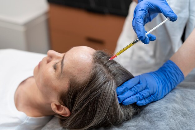 Key Benefits of PRP Hair Treatment for Hair Loss
