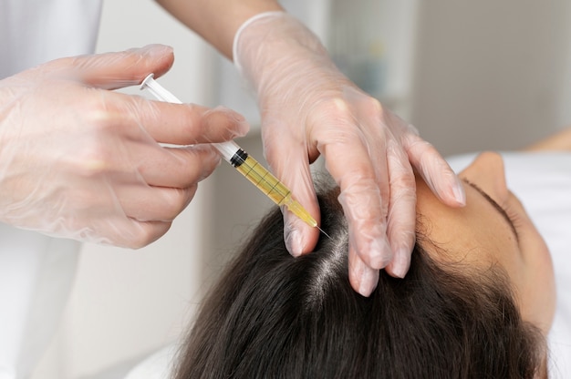 Key Benefits of PRP Hair Treatment for Hair Loss