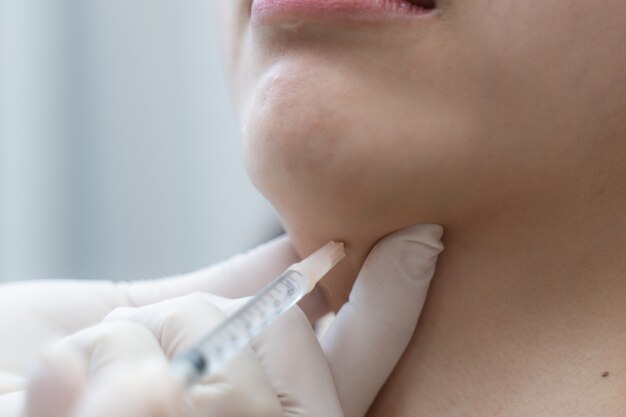 Chin Fat Dissolving Injections: Benefits & Expected Results