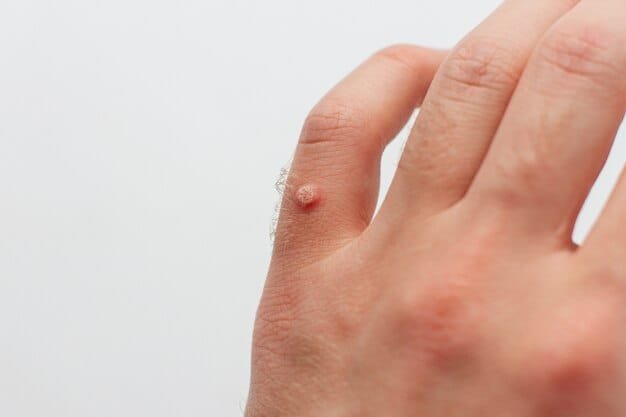 Skin Tag Treatment: Effective Ways to Remove Skin Tags on Face