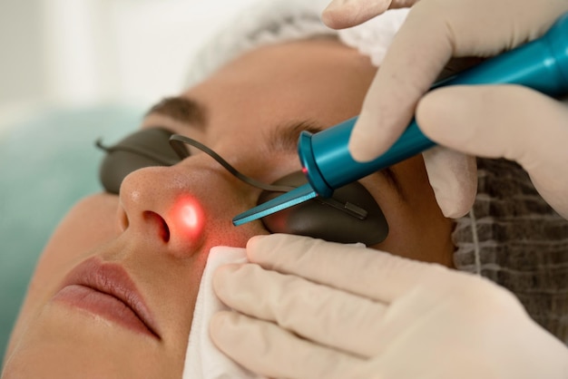 Laser Treatment for Moles on Face: Side Effects Explained