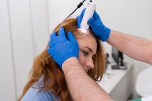 PRP Hair Treatment Side Effects: What to Expect