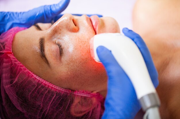 Q-Switch Laser Treatment: How It Works and What to Expect