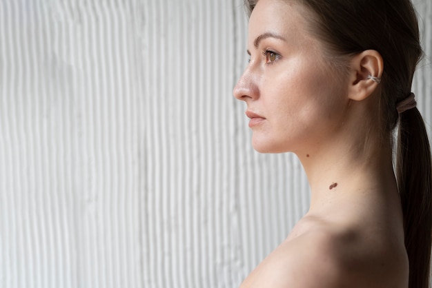 Black Mole Treatment: How to Safely Remove and Treat Moles
