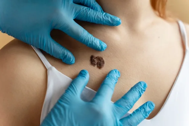 Infected Mole Treatment: How to Safely Treat Infected Moles