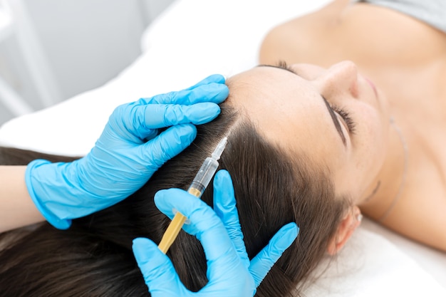 Top Questions About PRP Hair Treatment Answered