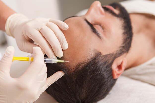 Top Questions About PRP Hair Treatment Answered