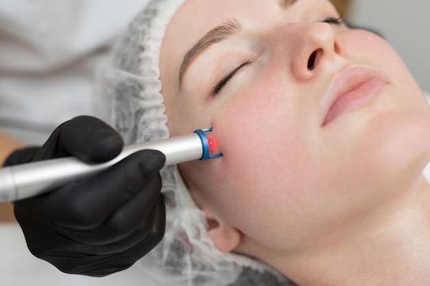 Why Laser Ablation Is the Best Treatment for Skin Tags in Islamabad