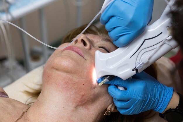 How Laser Ablation Helps Remove Skin Imperfections in Islamabad