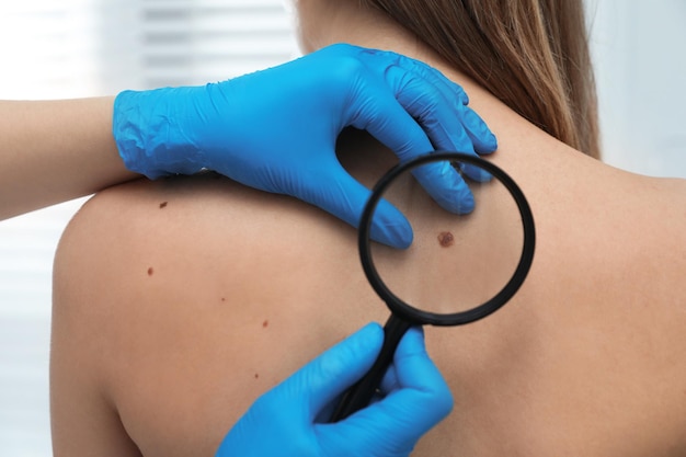 Laser Ablation: The Ultimate Solution for Skin Tags and Moles