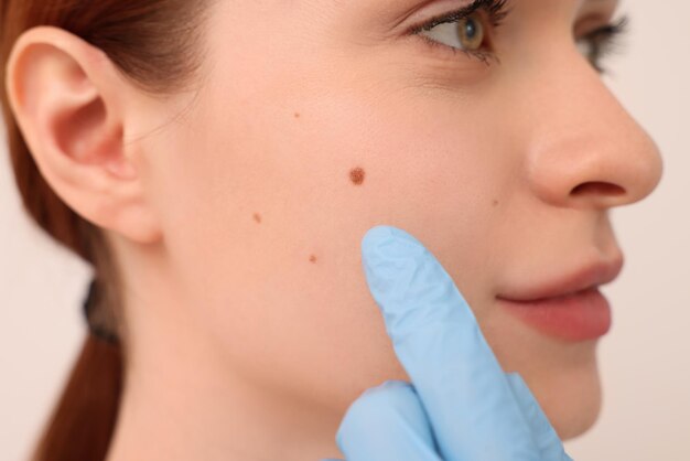 Treatment of Moles on Face: Safe and Effective Methods