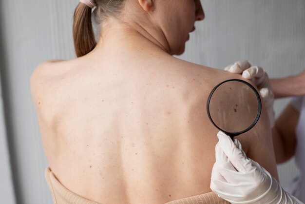 Laser Ablation: The Ultimate Solution for Skin Tags and Moles