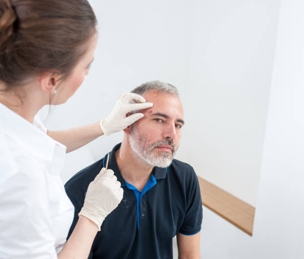 Treatment of Moles on Face: Safe and Effective Methods