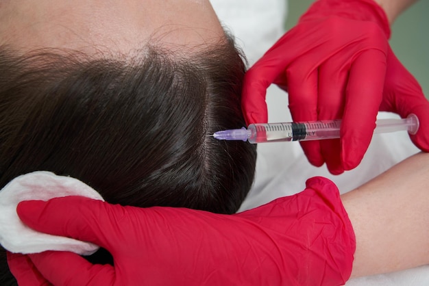 Why Islamabad Residents Prefer PRP for Hair Restoration