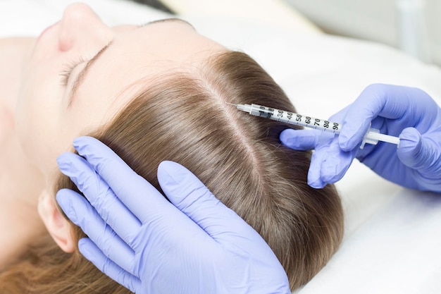 Top Questions About PRP Hair Treatment Answered