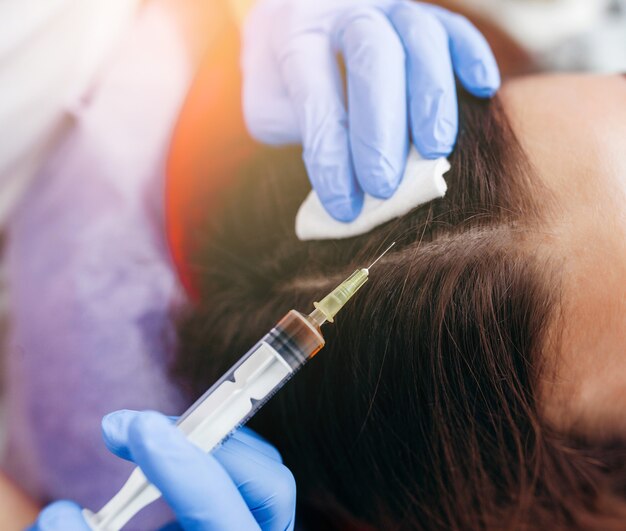 Why Islamabad Residents Prefer PRP for Hair Restoration