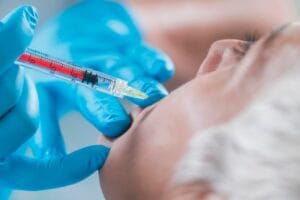 Transform Your Skin with PRP Treatment in Islamabad: A Complete Guide