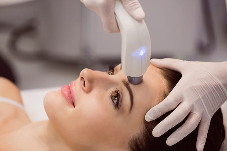 Cost of Q-Switch Laser Treatment in Islamabad Explained