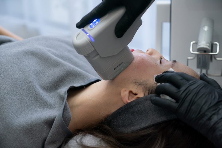 Cost of Q-Switch Laser Treatment in Islamabad Explained