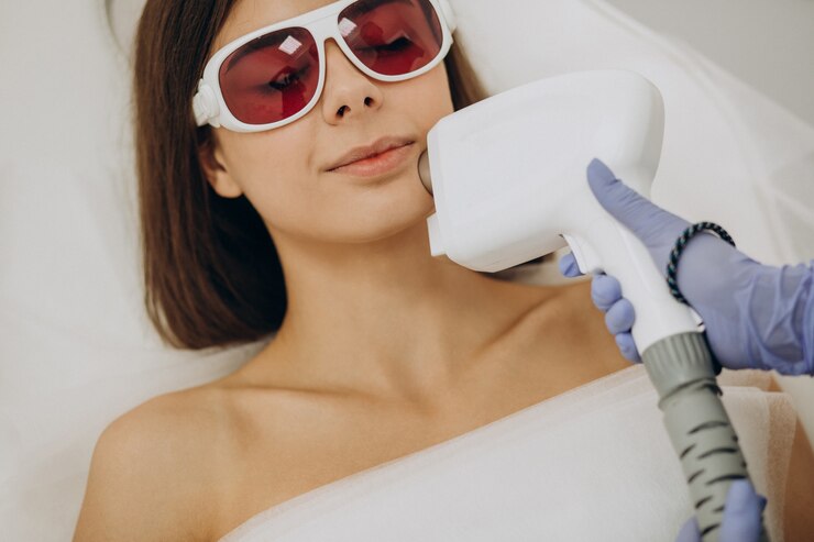 How Q-Switch Laser Enhances Skin Tone and Texture