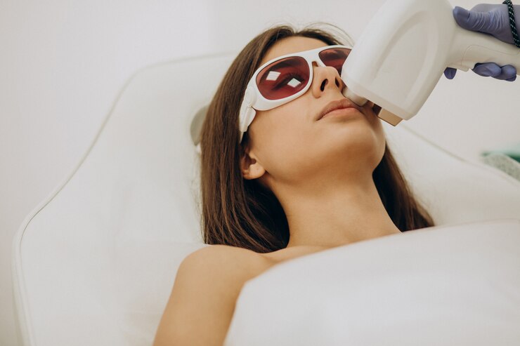 Q-Switch Laser: A Safe Way to Treat Skin Imperfections