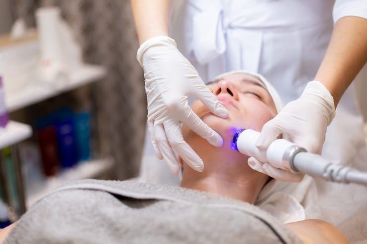 Cost of Q-Switch Laser Treatment in Islamabad Explained 