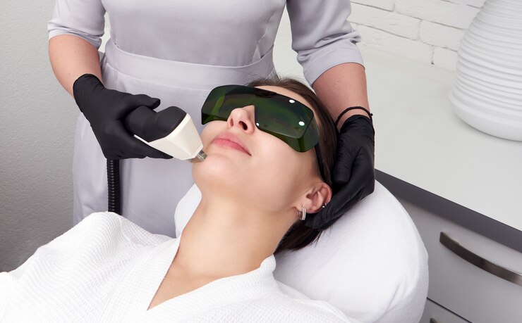 Top FAQs About Q-Switch Laser Treatment in Islamabad